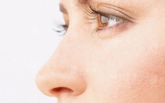 鼻子整形：假體與軟骨，哪種適合你？