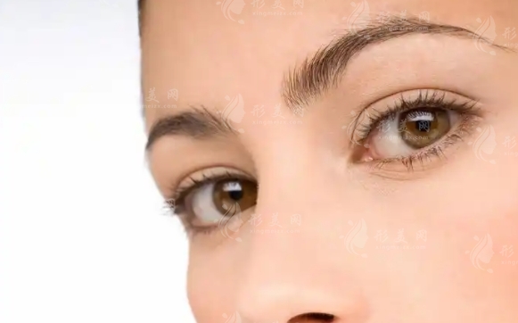 微創(chuàng)雙眼皮：長(zhǎng)期效果與潛在弊端