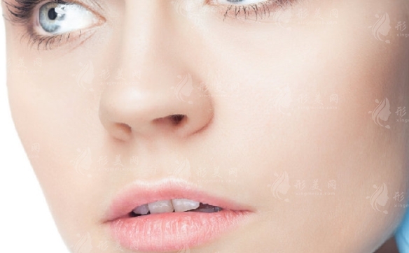 寬鼻矯正術(shù)后多久才能恢復(fù)？術(shù)后護(hù)理如何加快恢復(fù)時(shí)間？