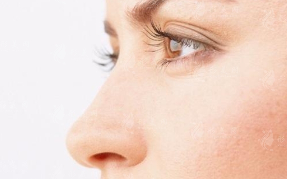 隆鼻后假體取出，鼻子會(huì)變形嗎？