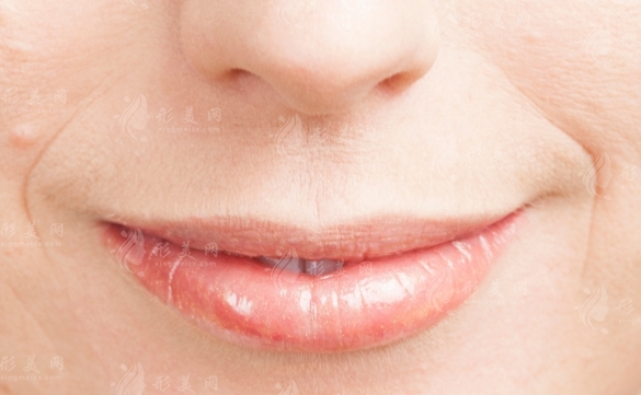 嘴角皺紋怎么去除|嘴角紋除去方式盤點~