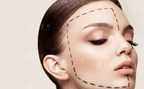 脂肪填充額頭過高：解決方案與改良策略