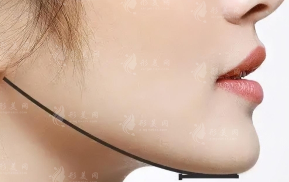 雙鄂手術(shù)和正頜手術(shù)的區(qū)別是什么？跟著小編一起來了解～