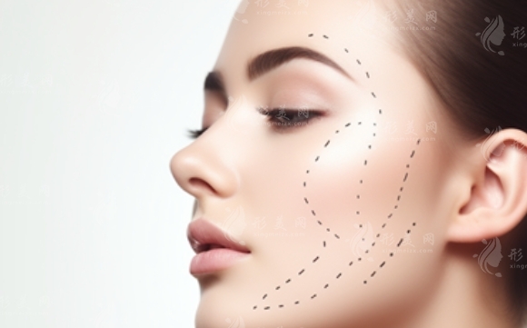 鼻骨縮小手術(shù)：原理與實(shí)現(xiàn)