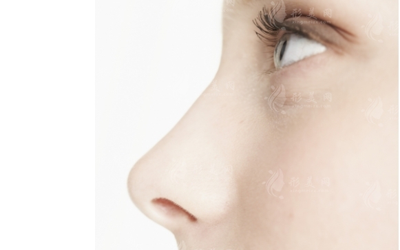 肥厚鼻尖矯正術(shù)安全性高嗎？