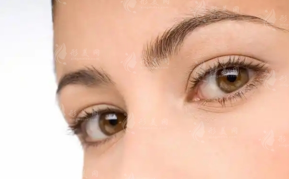 內(nèi)眥贅皮雙眼皮手術(shù)價(jià)格及影響因素 內(nèi)眥贅皮雙眼皮手術(shù)價(jià)格及影響因素