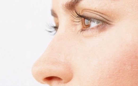 鼻梁歪斜的矯正手術(shù)方式與適宜人群