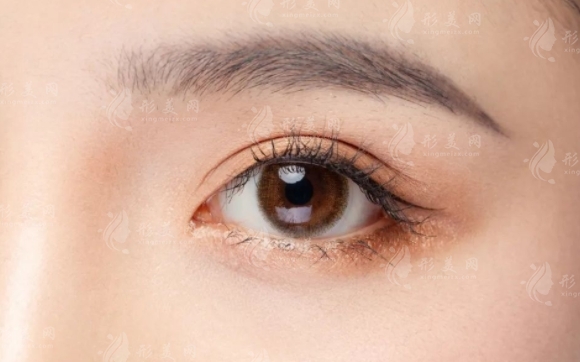 高分子埋線雙眼皮的價(jià)格與注意事項(xiàng)