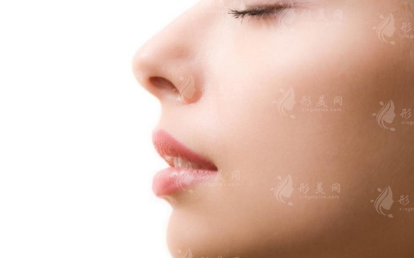 做個(gè)鼻梁需要多少錢？有沒有風(fēng)險(xiǎn)？