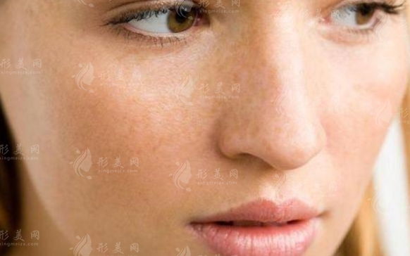 激光祛斑：安全有效，還是存在隱憂？