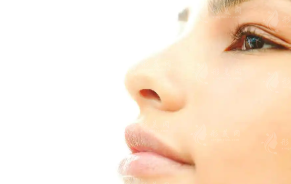 內(nèi)切鼻翼縮?。夯謴?fù)時(shí)間與疤痕問題解析