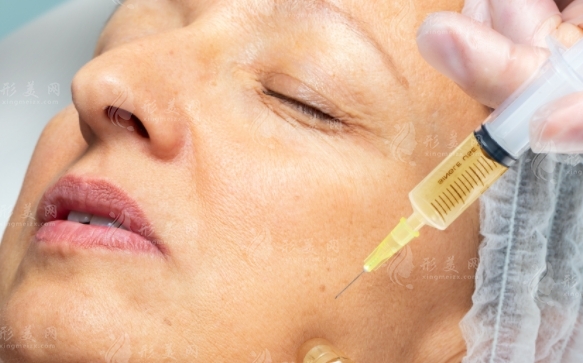 電波拉皮去皺術(shù)：重塑臉部肌膚的年輕魅力