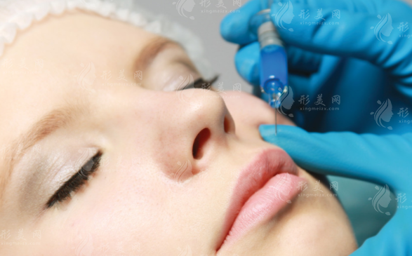 昆明玻尿酸注射哪家好?藝星銅雀臺(tái)吳氏嘉美價(jià)格技術(shù)對(duì)比