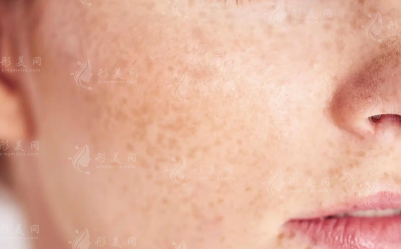 上海皮膚病醫(yī)院哪家好?江城皮膚醫(yī)院口碑實(shí)力全解析