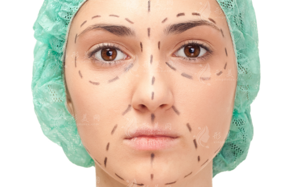 上海星璨李海濤拉皮靠譜嗎?筋膜復(fù)位技術(shù)口碑實(shí)測