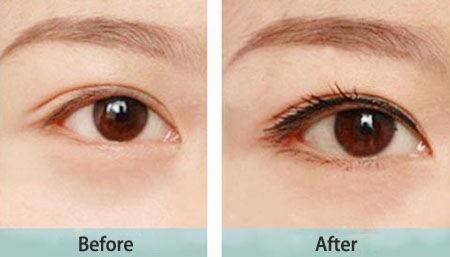 紋眉術(shù)價格是多少