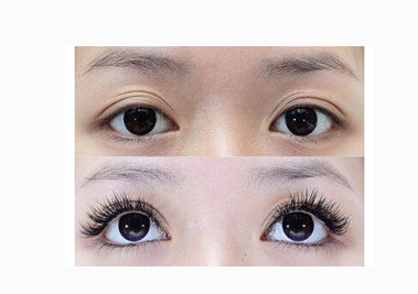 睫毛種植會(huì)會(huì)不會(huì)傷害到眼睛呢