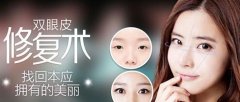 雙眼皮修復(fù)方法有哪些