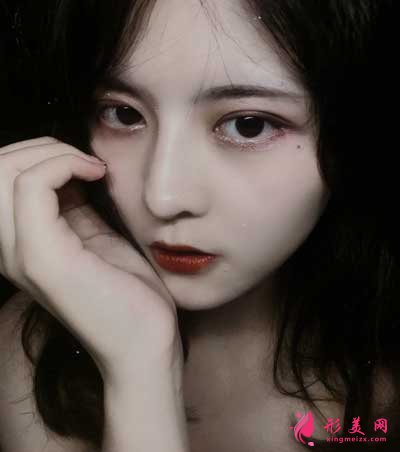 張雙溢醫(yī)生為我做的隆鼻整形手術(shù) 術(shù)后第15天效果圖