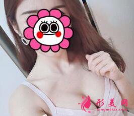 假體隆胸后需要注意的事項(xiàng)