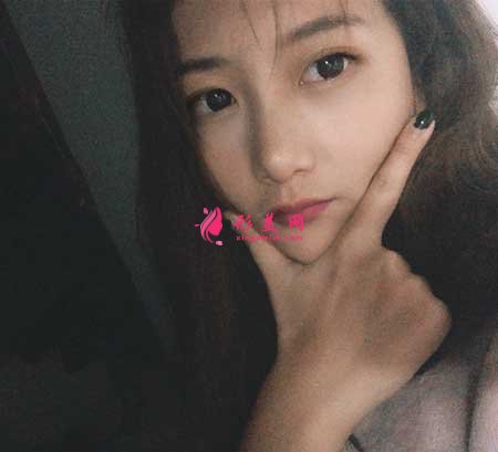 找南京黃金龍醫(yī)生做了隆鼻手術(shù)后，鼻子俊俏好看