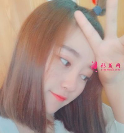 鄭州締萊美醫(yī)療美容醫(yī)院鼻部多項(xiàng)案例