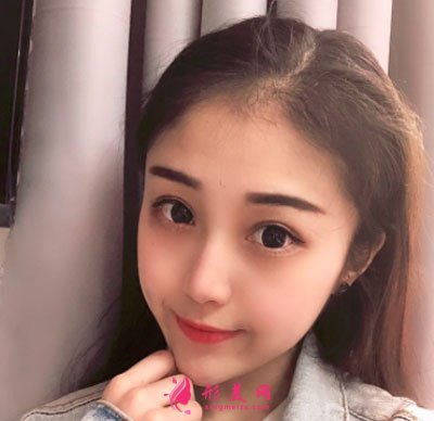 昆明美伊萊醫(yī)療美容鼻部多項案例