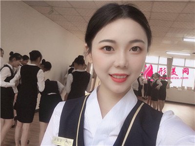 廣州小姐姐面部線雕提升術(shù)后效果對比 術(shù)后 廣州小姐姐面部線雕提升術(shù)后效果對比