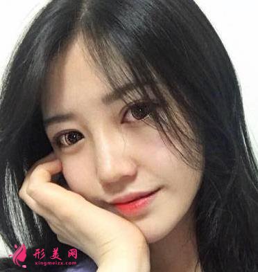 北京聯(lián)合麗格第一醫(yī)院雙眼皮案例分享！附2022價(jià)格表