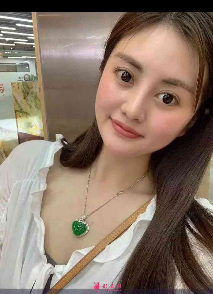 北京畫(huà)美醫(yī)療美容醫(yī)怎么樣？2021價(jià)格表公布+玻尿酸豐唇案例分享