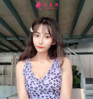 廣州廣大整形醫(yī)院面部輪廓價(jià)格價(jià)目表公開(kāi)!含實(shí)拍案例圖分享!