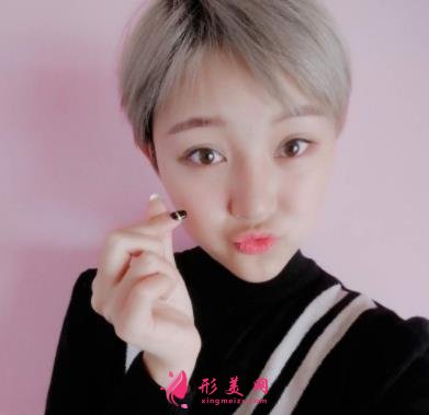 成都潤(rùn)美玉之光整形怎么樣？自體脂肪全臉填充案例和真實(shí)價(jià)格價(jià)目分享